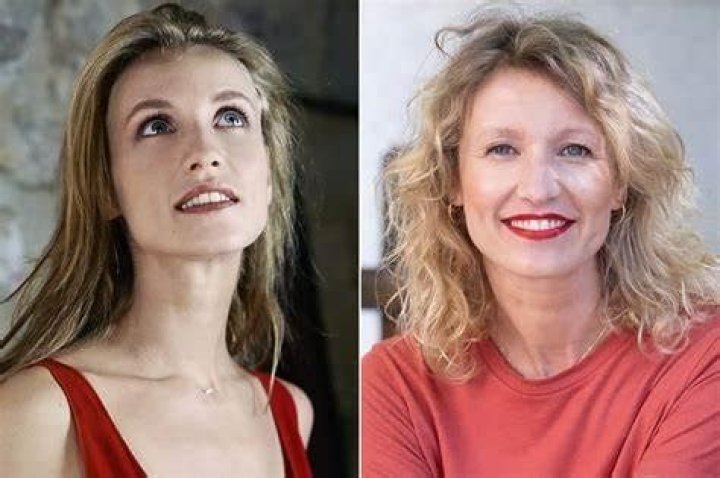 Alexandra Lamy Chirurgie