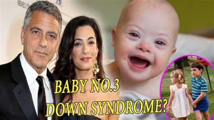 Clooney Twins And Down Syndrome: A Heartwarming Journey
