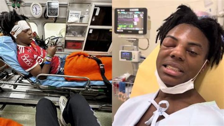 Did IShowSpeed meet with an accident? Real reason behind hospitalization explored