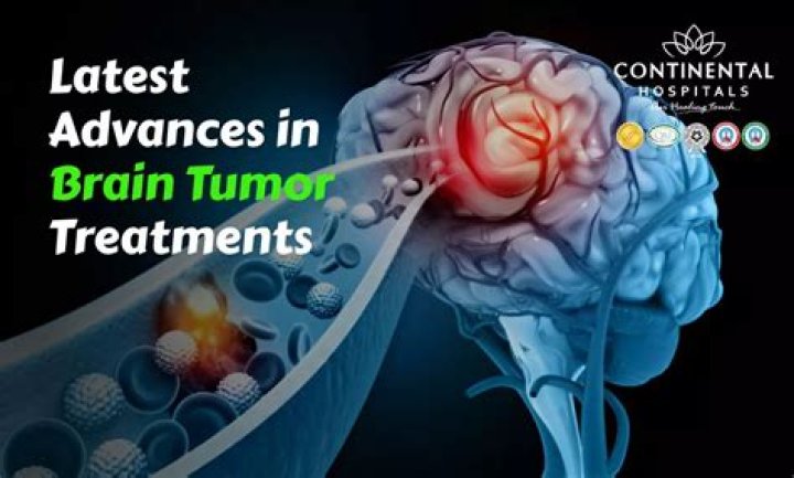 	Doctors to share advances on brain tumors	