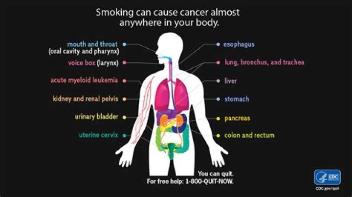 Does Toby Keith smoke? Health problems explored as singer reveals stomach cancer diagnosis