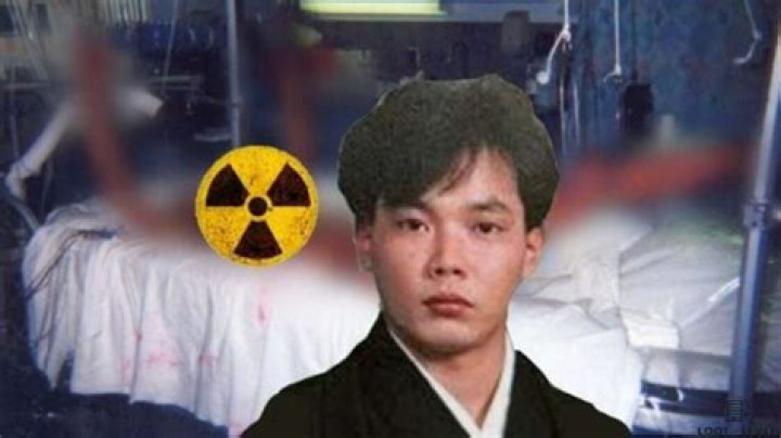 Exploring Ouchi Radiation Pictures: Understanding The Impact And Importance
