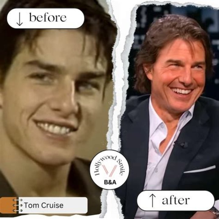 Exploring The Iconic Tom Cruise Smile: A Deep Dive Into Charm And Charisma
