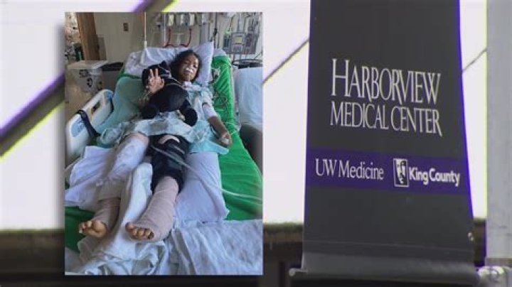 	GIRL HIT BY CAR	