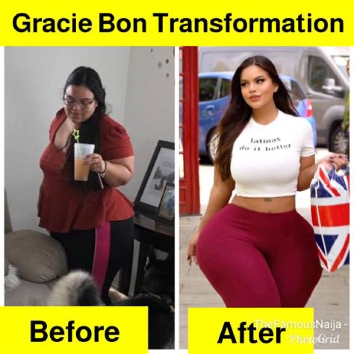 Gracie Bon Before Surgery: A Comprehensive Look At Her Journey