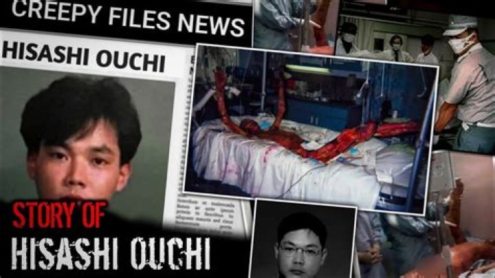 Hisashi Ouchi Injuries: A Deep Dive Into The Tragic Case