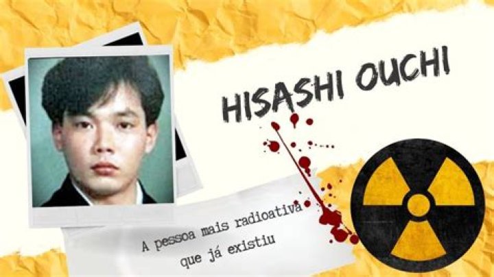 Hisashi Ouchi Photos: A Journey Through Tragedy And Resilience