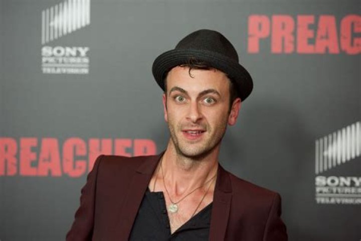 Joe Gilgun Net Worth: A Deep Dive Into The Wealth Of The Acclaimed Actor