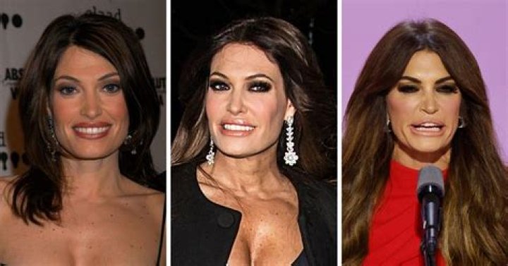 Kimberly Guilfoyle Plastic Surgery: Unveiling The Truth Behind Her Transformation