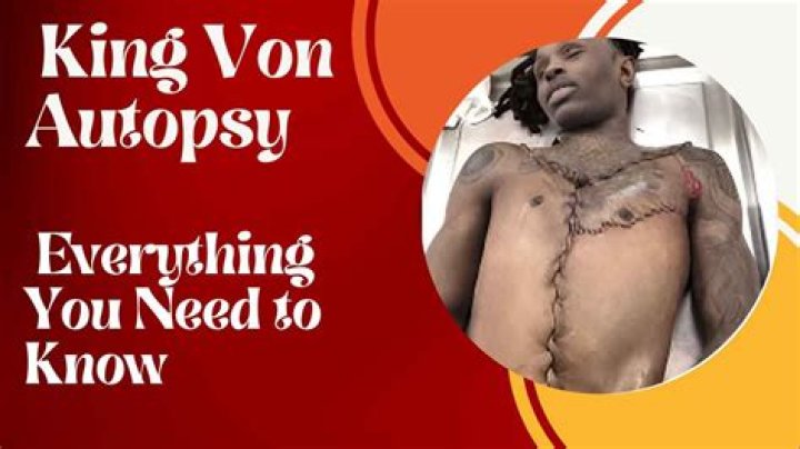 King Von Autopsy Photo: An In-Depth Exploration