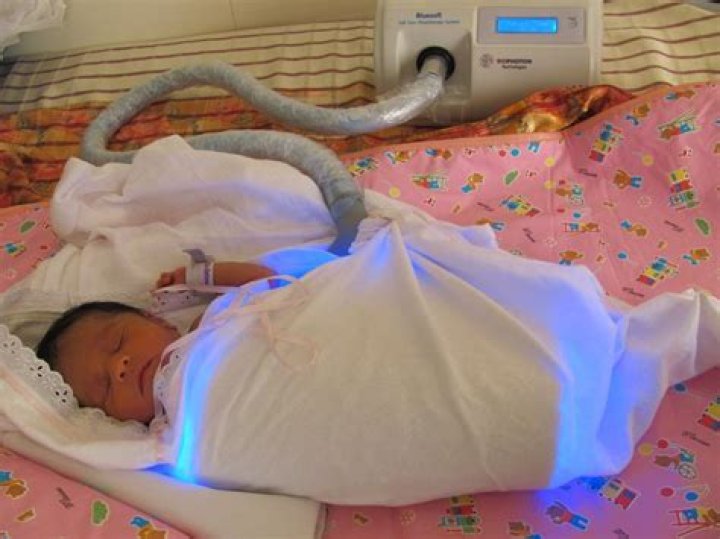 	LIGHT THERAPY FIBER-OPTIC BLANKETS TREAT INFANTS SUFFERING FROM SLIGHT JAUNDICE.	