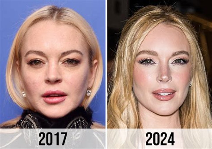Lindsay Lohan's Plastic Surgery Journey: Unlocking The Secrets Behind Her Transformation