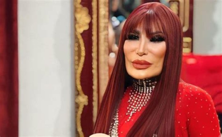 Lyn May: A Journey Through Transformation - Before And After