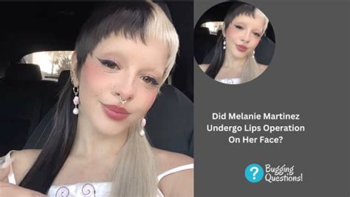Melanie Martinez's Face Surgery: Unveiling The Truth And Exploring Its Impact