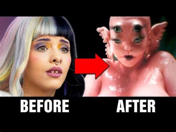 Melanie Martinez's Plastic Surgery: Uncovering The Suspected Enhancements