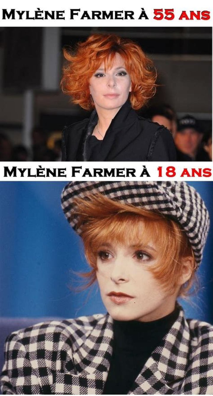 Mylene Farmer Chirurgie Esthétique