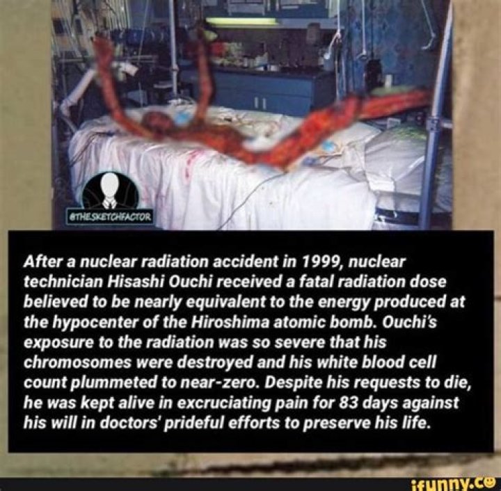 Ouchi Radiation Photo: Understanding The Impact And Implications