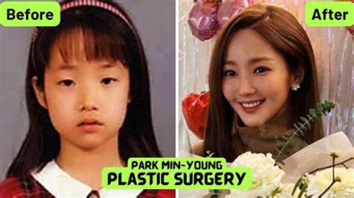 Park Min Young's Transformation: Uncovering The Journey Before Surgery