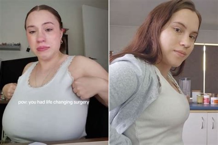 Sarah Beeston Had DDD Boobs Before Reducing Them