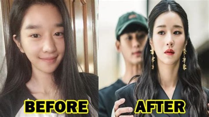SEO Ye-Ji Before Surgery: A Comprehensive Look At Her Transformation