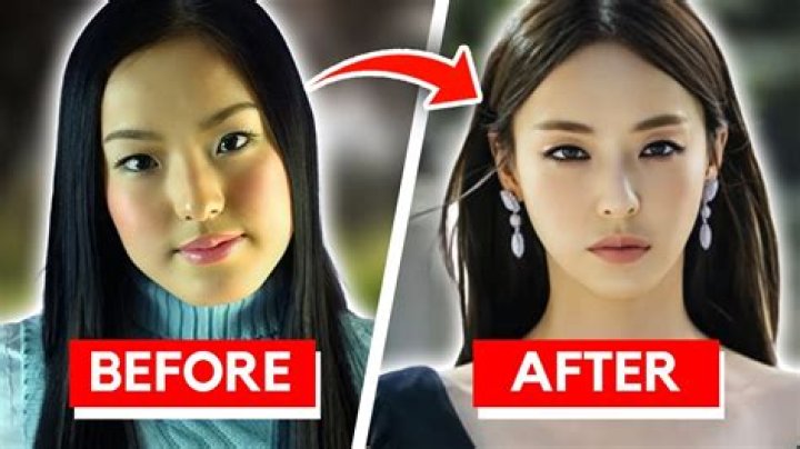 Suni Lee Before And After Plastic Surgery: A Complete Insight