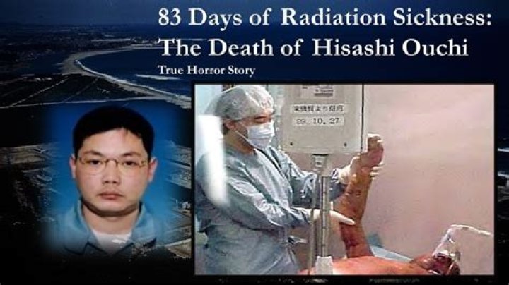 The Tragic Tale Of Hisashi Ouchi: A Lesson In Nuclear Safety