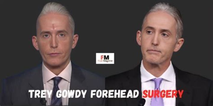 Trey Gowdy Plastic Surgery: The Truth Behind The Transformations