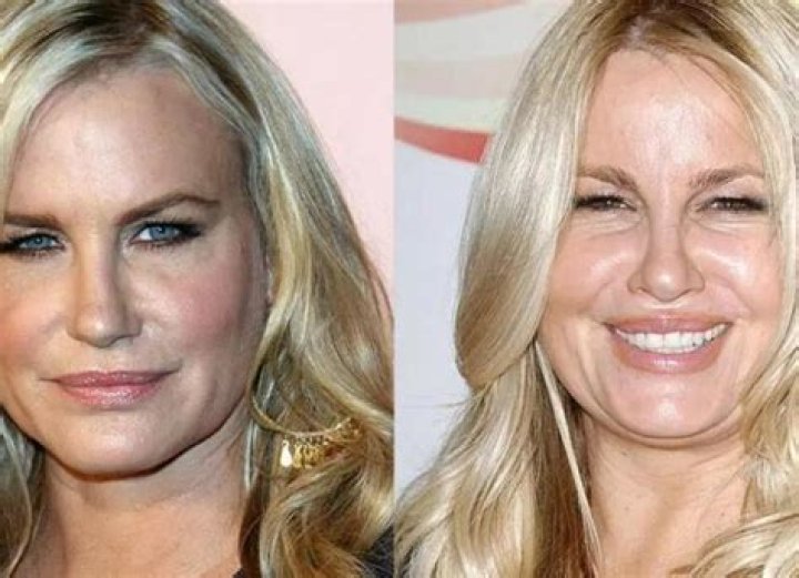 Truth Behind Jennifer Coolidge’s Plastic Surgery Rumors
