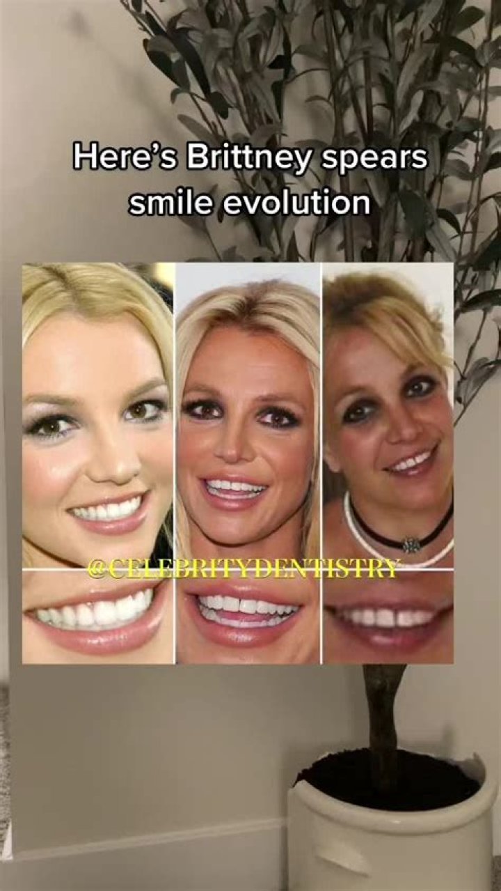 Uncover The Secrets Of Britney Spears' Perfect Smile