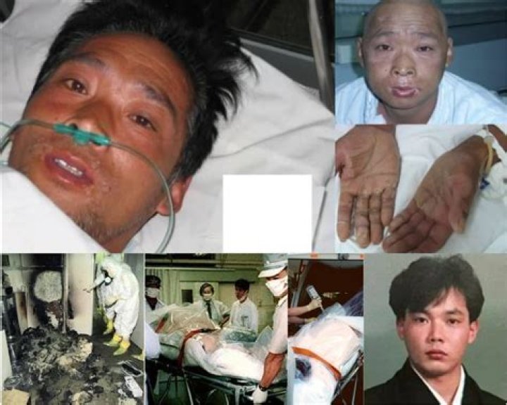Understanding Hisashi Ouchi: The Tragic Tale Of A Nuclear Accident Victim