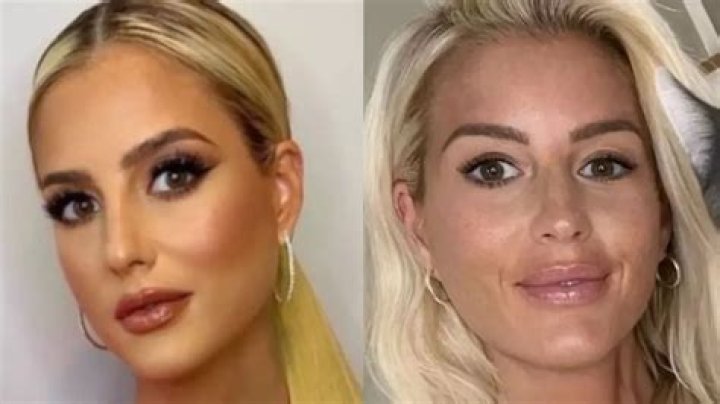 Unveiling The Natural Beauty Of Emma Hernan Without Makeup