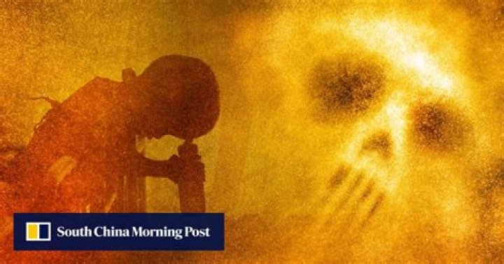 Vietnam war: 44 years on, birth defects from America’s Agent Orange are increasing