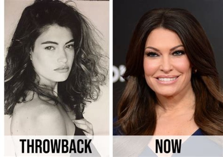 What Happened To Kimberly Guilfoyle's Face: A Comprehensive Overview