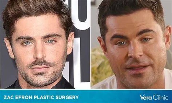 Zac Efron: The Transformation Journey Through Plastic Surgeries